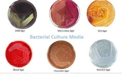 soft agar deep tests for what type of media|Bacterial Culture Media: Classification, Types, Uses.